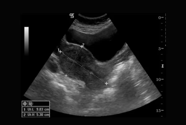 Pelvic Sonography