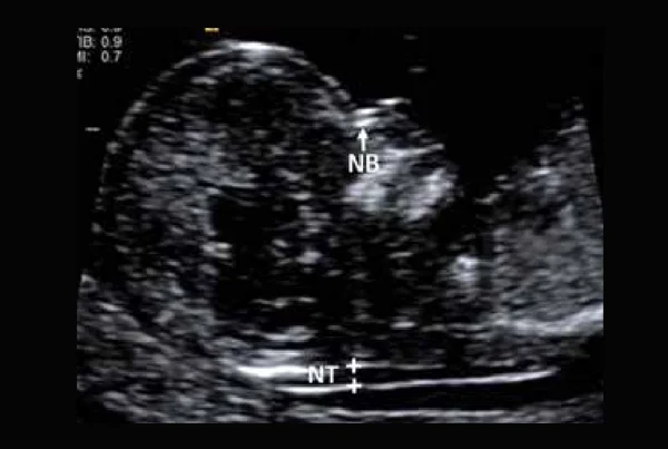 NT/NB Scan