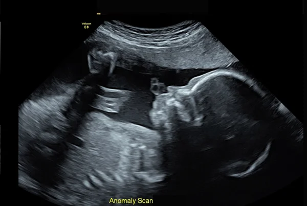 Anomaly Scan