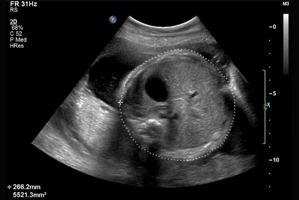 Fetal Well Being (Routine)