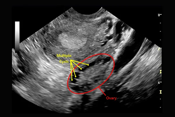 Ovulation